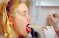 Ларингит: фото как выглядит больное горло у взрослого