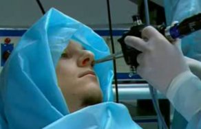 Хирургическое лечение при гайморите: операция по очистке гайморовых пазух